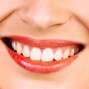 Косметическое восстановление зубов в Алматы фото