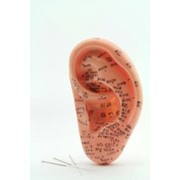 Аурикулярная акупунктура фото