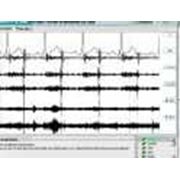 Комплект фонокардиографических исследований ФКГ фото