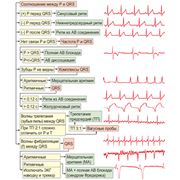 Буклет-линейка Электрокардиография. Квинтэссенция Плешков Ф. И. фото