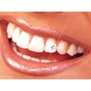 Зубные украшения зуботехнические инструменты фото