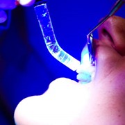 Лечение корневых каналов зубов фото