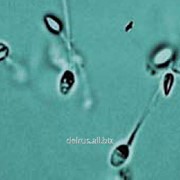 Устройство регистрирующее для определения морфологии сперматозоидов OCTAX сytoScreen фотография