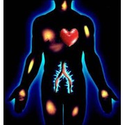 Диагностика Intera-DiaCor фото