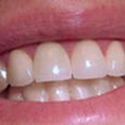 Лечение и протезирование зубов фотография