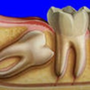Хирургическая стоматология в алматы фото