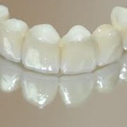 Съемное протезирование зубов. фотография