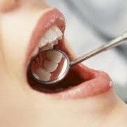 Терапевтическая стоматология,Пломба из стеклоиономерного цемента фото
