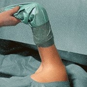 Сигма Мед Foliodrape Protect Plus Shoulder Arthroscopy Set / Комплект для артроскопии плеча, 5 шт. (9387021) фото