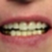 Терапевтическая стоматология фото