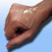Прозрачная пленка из силиконового геля, предназначенная для лечения грубых рубцов