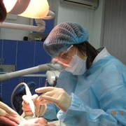 Снятие мягких зубныхотложений (налет) фотография