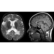 МРТ головного мозга и гипофиза