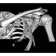 Компьютерная томография суставов фото
