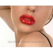 Увеличение объема губ, Теосиаль Кисс, 1 мл фото