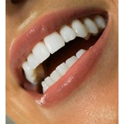 Эстетическая реставрация боковых зубов