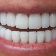 Лечение и реставрация зубов в Алматы фотография
