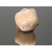 Протезирование зубов металлокерамическими протезами
