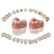 Ортопедия - протезирование зубов фото