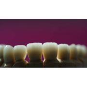 Ортодонтическая стоматология фотография
