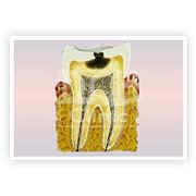 Скорая стоматологическая помощь