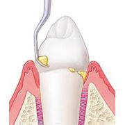 Профессиональная гигиена полости рта
