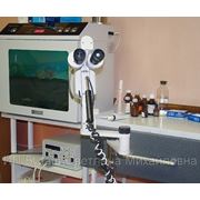 Відеокольпоскопія — сучасна гінекологічна діагностика фотография