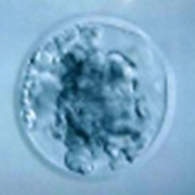 Замораживание эмбрионов, эмбрион фотография