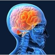 МРТ головного мозга и сосудов головного мозга фото