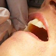 Бормашины стоматологические