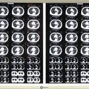 Медицинский светодиодный негатоскоп для 2-х рентгеновсих снимков фото