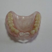 Ортопедическая стоматология (протезирование) фото