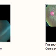 Казахский научно-исследовательский институт глазных болезней, ГП фото