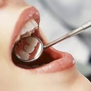 Пломбирование зубов