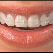 Ортодонтическая стоматология фотография