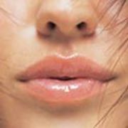 Омоложение лица, изменение формы губ фотография