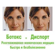 Лечение мимических морщин диспортом и ботоксом фотография