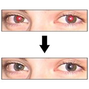 Удаление эфекта красных глаз