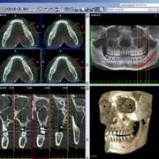 Магнитно-резонансная томография зубов