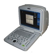 Прибор ультразвуковой сканирующий ULTIMA SM фото