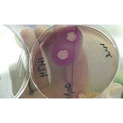Бакпосевы (Бактериологические исследования) фотография