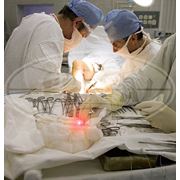 Лазерная медицина в хирургии фотография