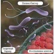 Гастроэнтерология. Диагностика хеликобактер пилори. Клиника семейной и неотложной медицины “ГИППОКРАТ“. фото