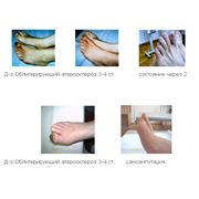 Лечение атеросклеротических заболеваний конечностей фотография