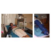 Награда 2011 года в номинации: Лазерное лечение трофических язв и гангренозных осложнений Лечение рожистого воспаления нижних конечностей. Лазер+ Озон---- 10 сеансов