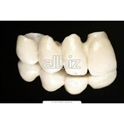 Протезирование зубов Житомир фото