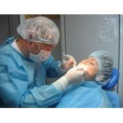 Имплантация в Полтаве качественное лечение и протезирование зубов. фото