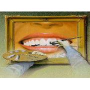 Эстетическая реставрация зубов Донецк