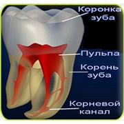 Лечение зубных каналов цена Киев. Лечим зубные каналы в Киеве. Лечение каналов зубов цена.Лечение каналов зуба. Лечения канала зуба фото