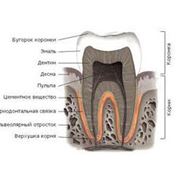 Лечение зубных каналов фото
